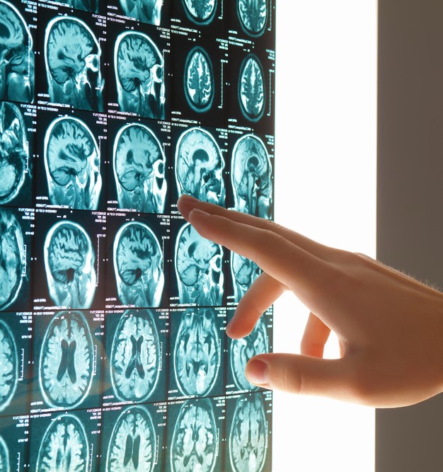 Close-up image of doctor's hand pointing at x-ray results-1